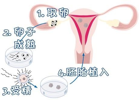 代生儿子包性别